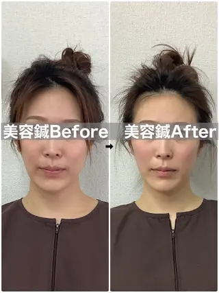 ハリサロンドオフ 美容鍼灸×小顔整体のエステ・リラクイメージ