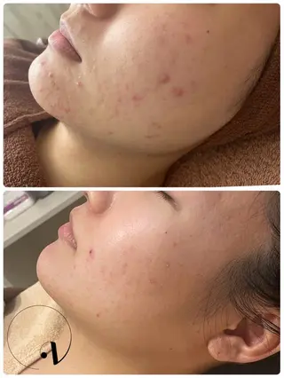 ハーブピーリング専門 グランディール　武内のエステ・リラクイメージ