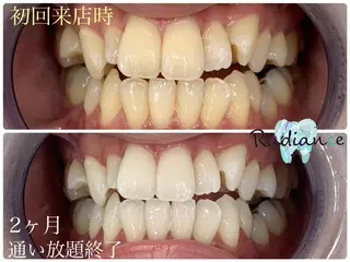 札幌ホワイトニング ラディアンス菊水店のその他イメージ