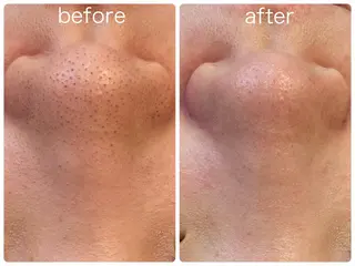 Hisui 小出のエステ・リラクイメージ