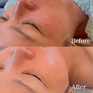 グリーンピール専門店 サロンY【大阪】のエステ・リラクイメージ