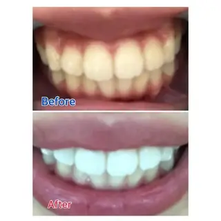 M渋谷 ホワイトニングのエステ・リラクイメージ