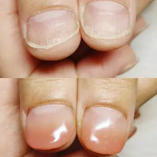 ネイル 深爪矯正/爪育成ケア manie nailのネイルデザイン