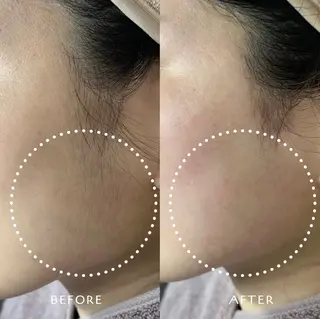 フェイシャルワックス KANAKOのエステ・リラクイメージ