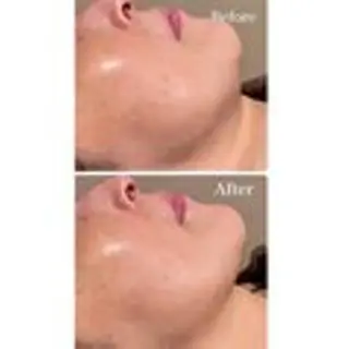 肌管理専門店 Santevistaのエステ・リラクイメージ