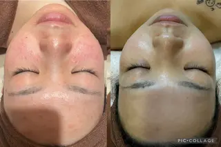 🌷U24特別サロン レイビス銀座店🌷のエステ・リラクイメージ