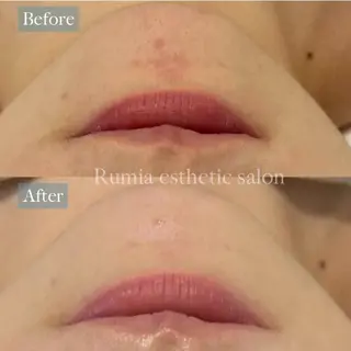 Rumia Salonのエステ・リラクイメージ