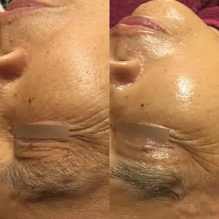 🏳️‍🌈 CHIYAKAのエステ・リラクイメージ