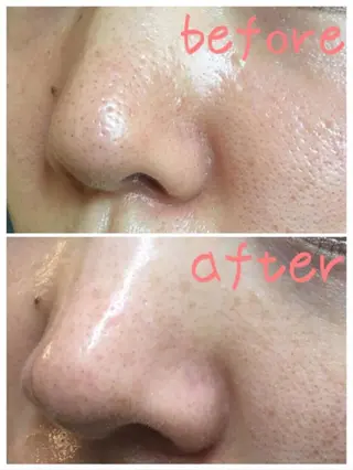 メンズ 朝重い人専用 肩甲骨調整のエステ・リラクイメージ