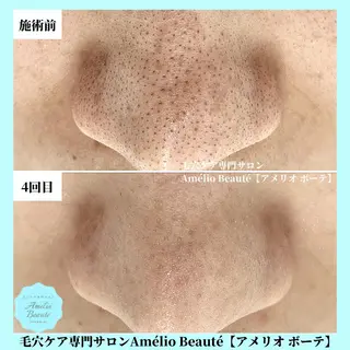 毛穴ケア専門サロン アメリオボーテのその他イメージ