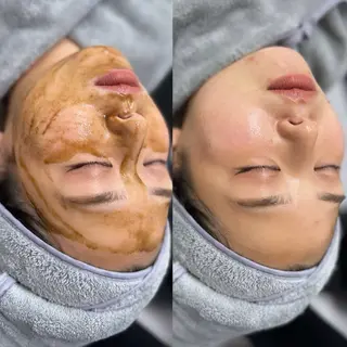 luna所属・N REINAのエステ・リラクイメージ