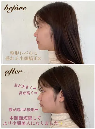 盛れる小顔矯正師 たく先生のエステ・リラクイメージ