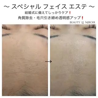 マツエク・マツパ ビューティー ミロワールのエステ・リラクイメージ