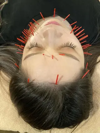 美容鍼サロンAcutyアキュティ吉祥寺所属・橋爪 弘樹のその他イメージ