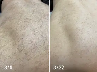 メンズ Sugaring / HILOT TAOのエステ・リラクイメージ