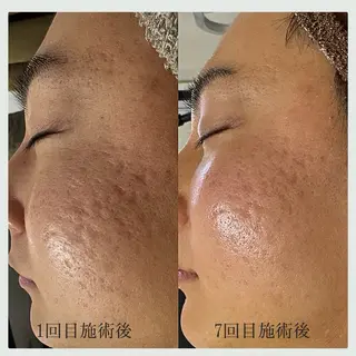 Florence  〜salon de nurse所属・Florence めぐみのエステ・リラクイメージ