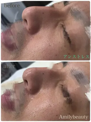 Amily beauty 毛利のエステ・リラクイメージ