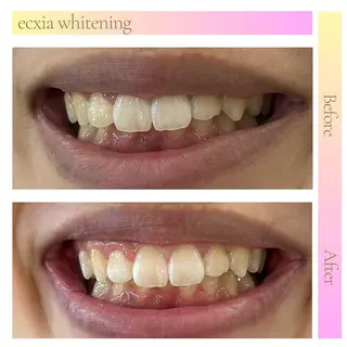 ecxia新白河店 ゆきのその他イメージ