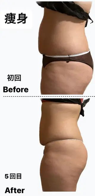 🌴Beauty Salon LANAのエステ・リラクイメージ