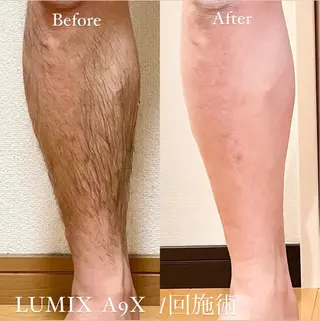 メンズ 鍼灸サロン TIARA　美容鍼のエステ・リラクイメージ