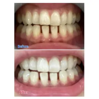 M渋谷 ホワイトニングのエステ・リラクイメージ