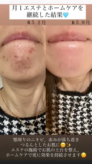 Salon de Lino 御器所のエステ・リラクイメージ