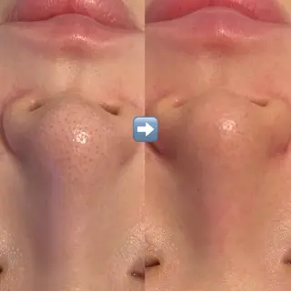 韓国肌管理Belle 赤羽のエステ・リラクイメージ