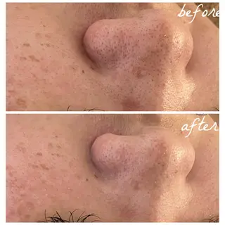 メンズ メナード岐阜茜部 杉浦のエステ・リラクイメージ