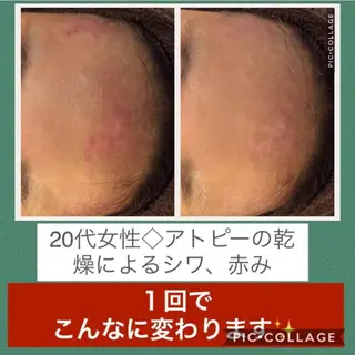 ミディアム カラー パーマ ヘアアレンジ メンズ キッズ ネイル マツエク・マツパ ニキビ・肌質改善専門 ♡人生が変わるサロンのエステ・リラクイメージ