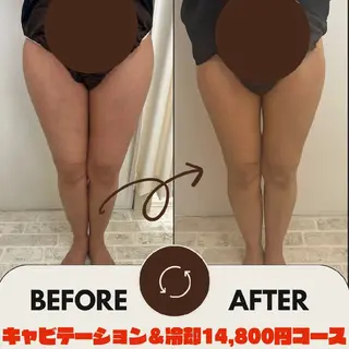 脂肪冷却・脱毛サロン coconoix のエステ・リラクイメージ