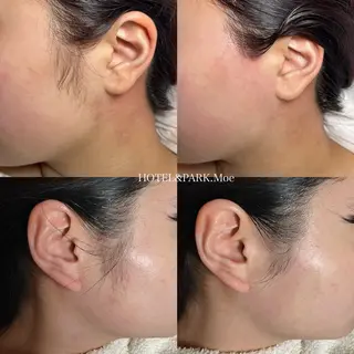 HOTEL&PARK .Moeワックス脱毛のエステ・リラクイメージ