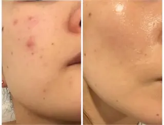 ビューティーサロン　プリズム所属・久留本 茜のエステ・リラクイメージ