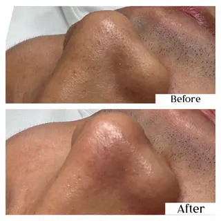 Hémireve Shirokane所属・トロイアルケ🩵 美眉EMIの眉毛・アイブロウイメージ