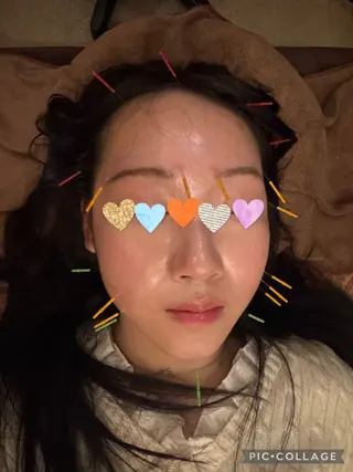 Acupuncture  salon LINOA リノア鍼灸院所属・LINOAヘッドスパ 小顔ケア/逆子ケアのエステ・リラクイメージ