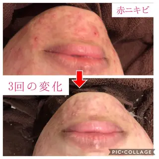 セミロング カラー パーマ ヘアアレンジ メンズ キッズ ネイル マツエク・マツパ 金の糸脱毛 産毛ケア専門のエステ・リラクイメージ