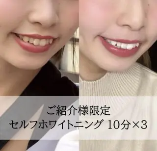 ホワイトニング専門店 LCS 汐留店 森田のその他イメージ