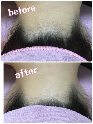 BELLEFINE 💕痩身・小顔・脱毛のエステ・リラクイメージ