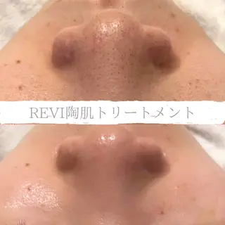 小顔&デコルテ Spa “koti”のエステ・リラクイメージ