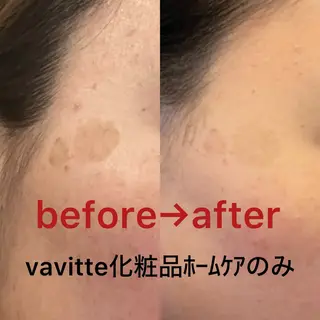LaBeIIevie ラベルヴィのマツエク・マツパデザイン