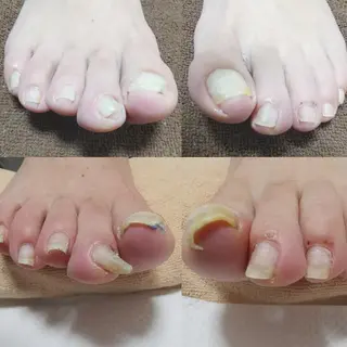 ネイル reve あやののネイルデザイン