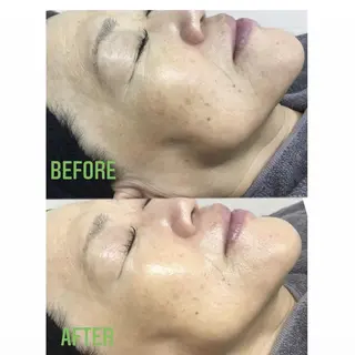 プラティーヌ ボーテのその他イメージ