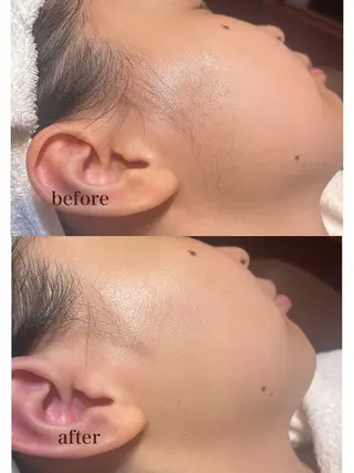 レディースシェーブ ☺️米村美紀のエステ・リラクイメージ