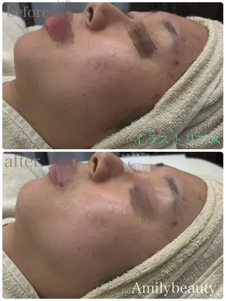 Amily beauty 毛利のエステ・リラクイメージ