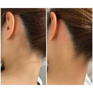 エステサロン Mi-mi.iのエステ・リラクイメージ