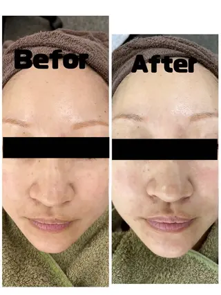 Beauty salon Lakiのエステ・リラクイメージ