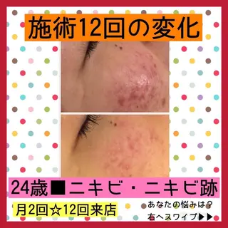 ミディアム カラー パーマ ヘアアレンジ メンズ キッズ ネイル マツエク・マツパ ニキビ・肌質改善専門 ♡人生が変わるサロンのエステ・リラクイメージ