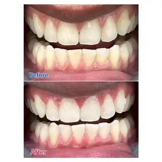 Ｍ渋谷 ホワイトニングのエステ・リラクイメージ