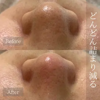 emiiny 🌿フェイシャルのエステ・リラクイメージ