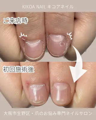 ネイル KIKOA NAIL キコアネイルのネイルデザイン