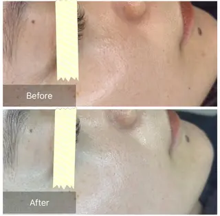 トータルしみケア専門 NICA(ニカ)の眉毛・アイブロウイメージ